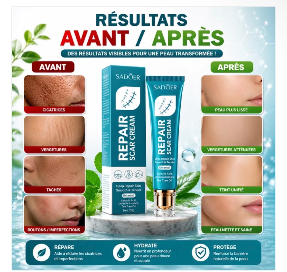 La Crème qui traite avec efficacité cicatrice - vergeture - quintos