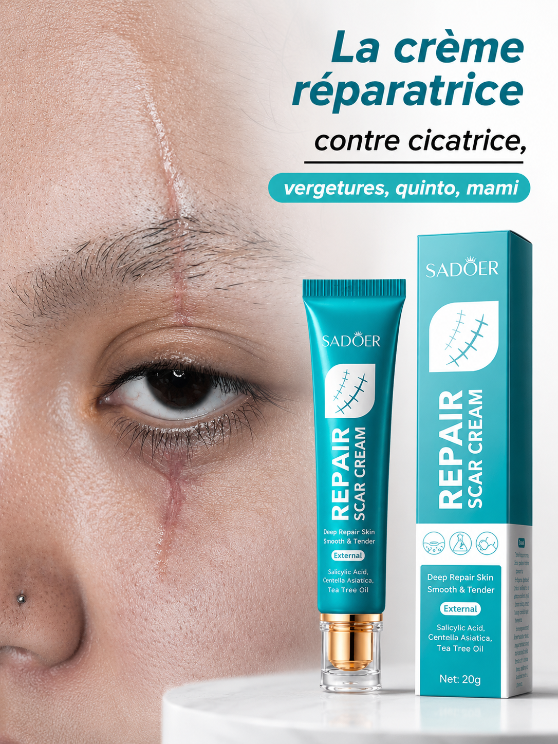 La Crème qui traite avec efficacité cicatrice - vergeture - quintos